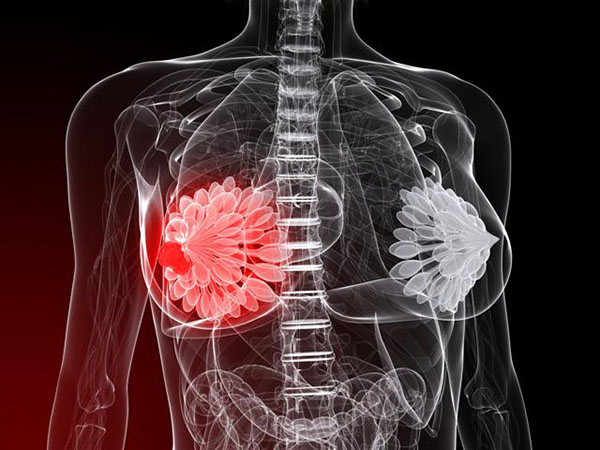 маммология рак молочной железы рак груди обследование грудной железы
